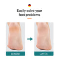 Foot File Double Sided Callus Remover For Dead Skin Professional Pedicure Tools Callous Scraper Foot Sander Heel Filer