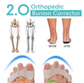 Orthopedic Bunion Corrector 2.0(1 PAIR)